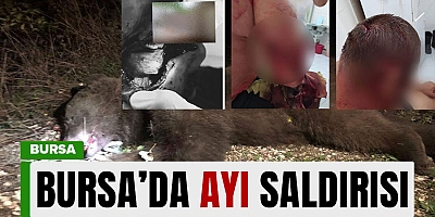 Bursa’da ayı saldırısı! Birinin yüzü parçalandı…